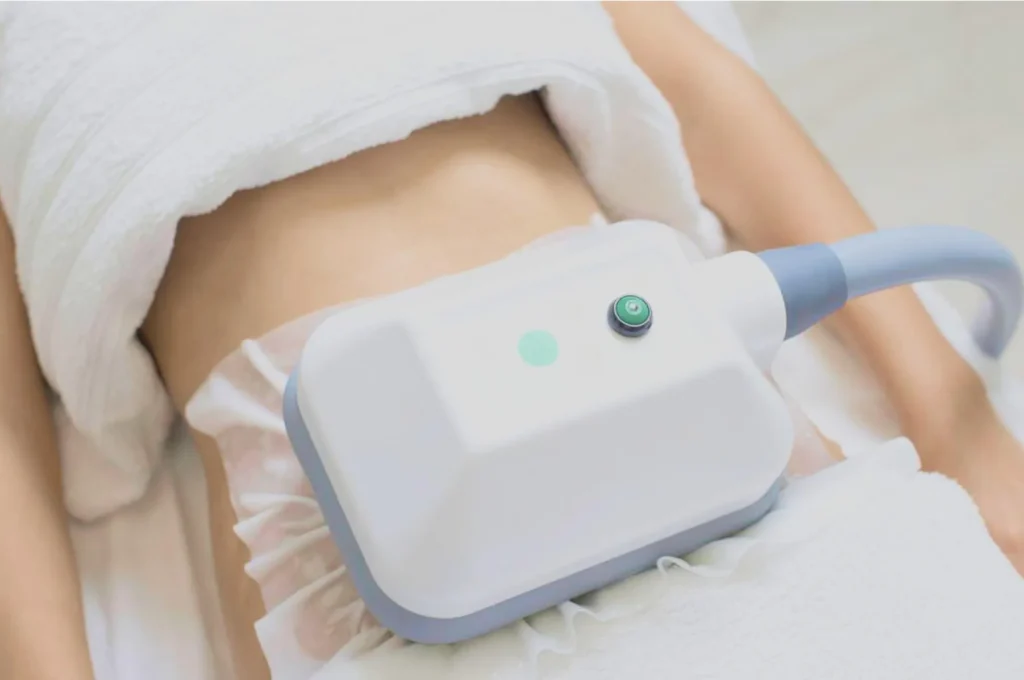 How Fat Freezing and HIFU Work Together? 3 advantages to combining Fat Freezing and HIFU Rhyl