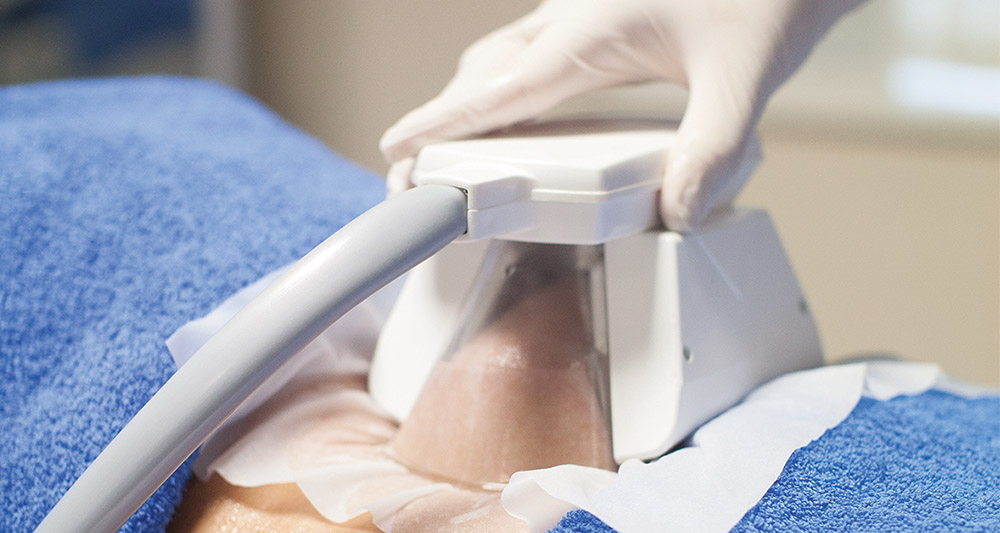 How Fat Freezing and HIFU Work Together? 2 Multiple Areas in One Session HIFU and Fat Freezing Rhyl