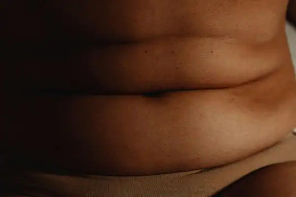 The Hidden Connection: How Stress Shapes Your Fitness and Body Composition 3 image of what stress can do on the stomach area and how Lipo 360 Rhyl can help to change your body shape.